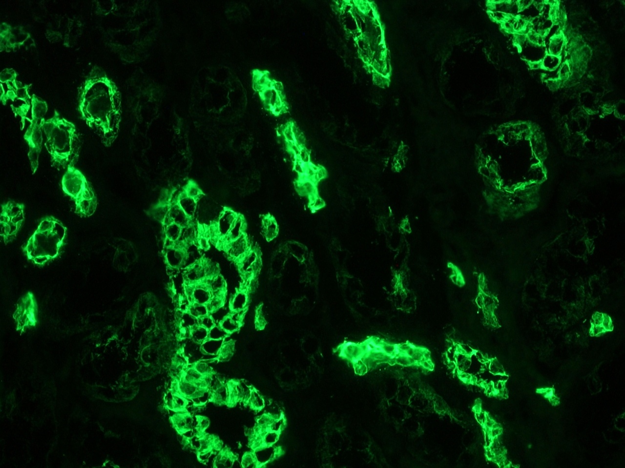 Figure 8. MUB0316P (clone OVTL12-30)  indirect immunofluorescence staining of a frozen section of human kidney at a 1:500x dilution. Note only strong reactivity in the epithelial ducts and no staning in connective tissue or glomeruli.